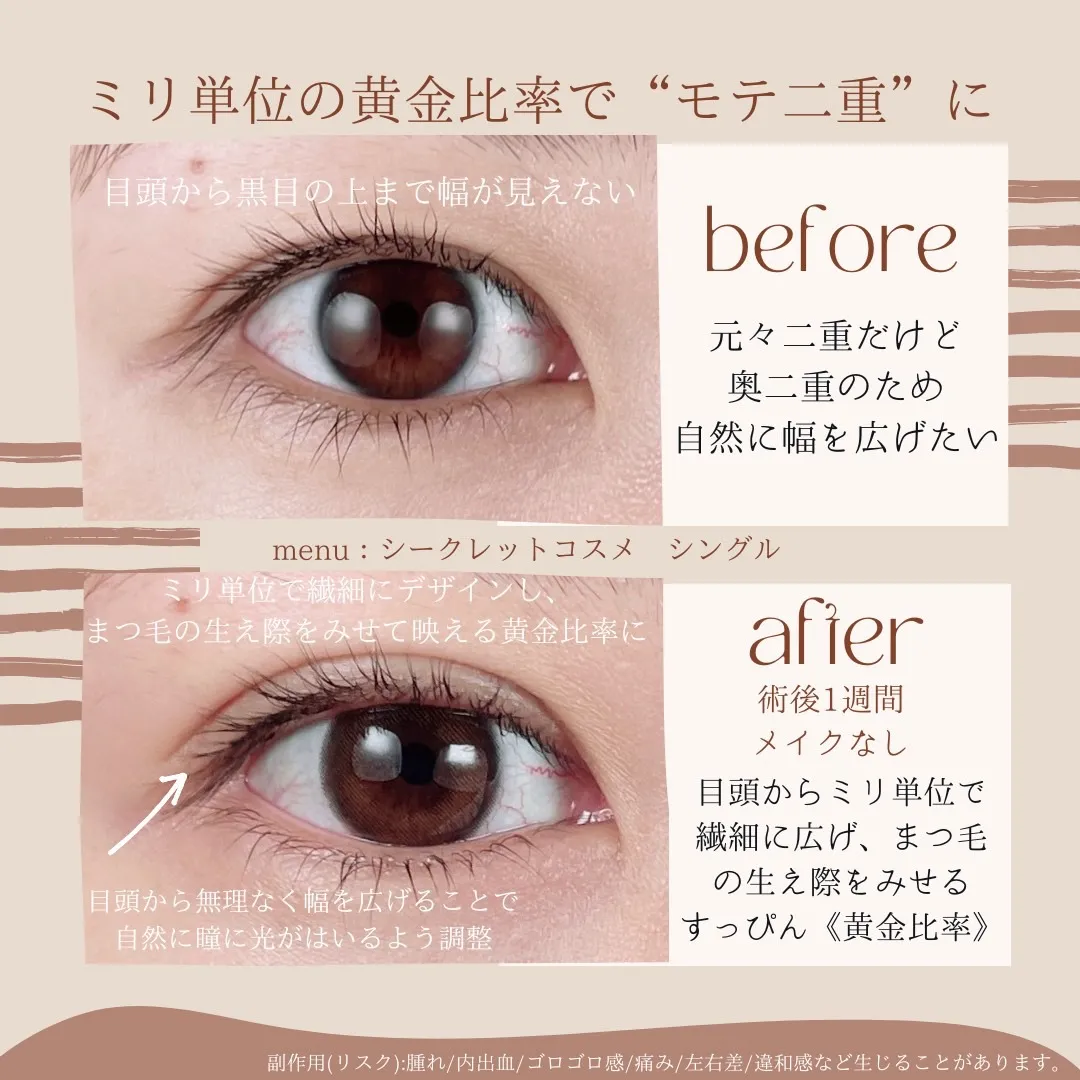 before・after画像