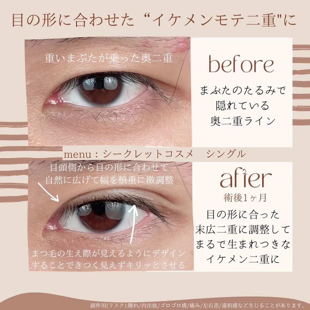 before・after画像