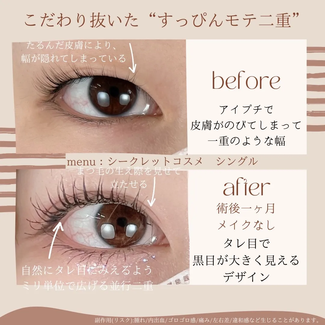 before・after画像