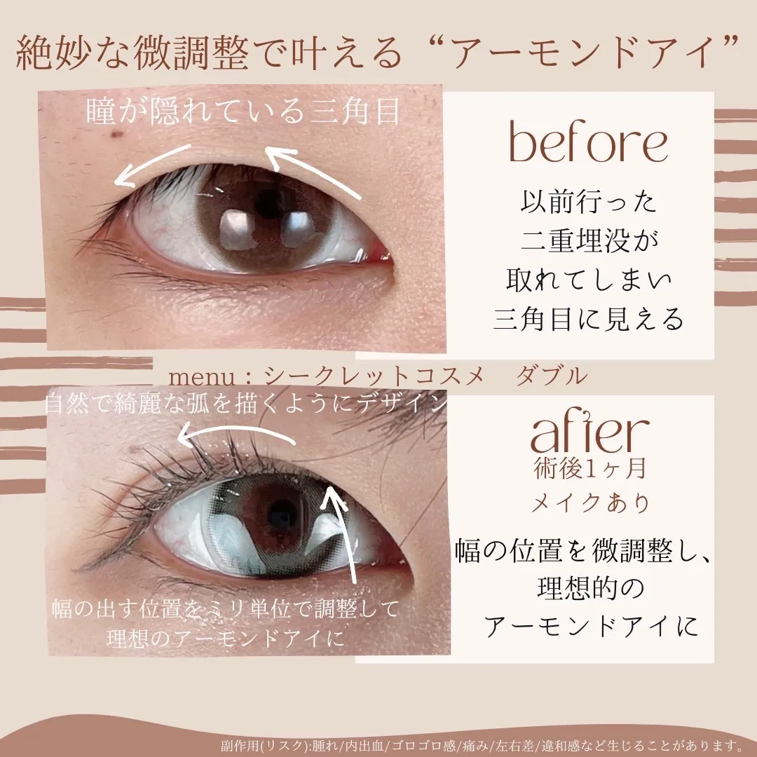 before・after画像