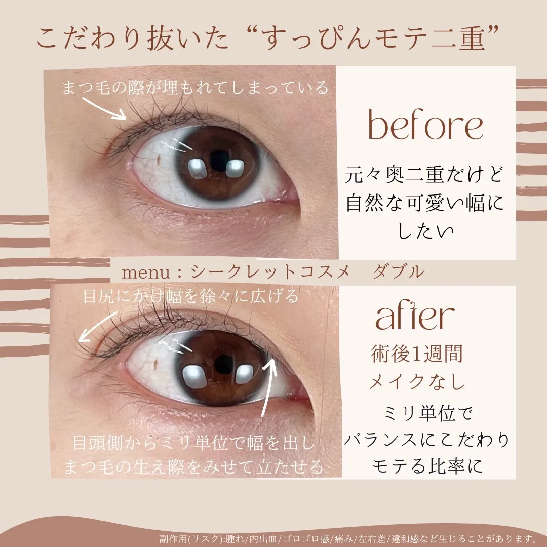 before・after画像