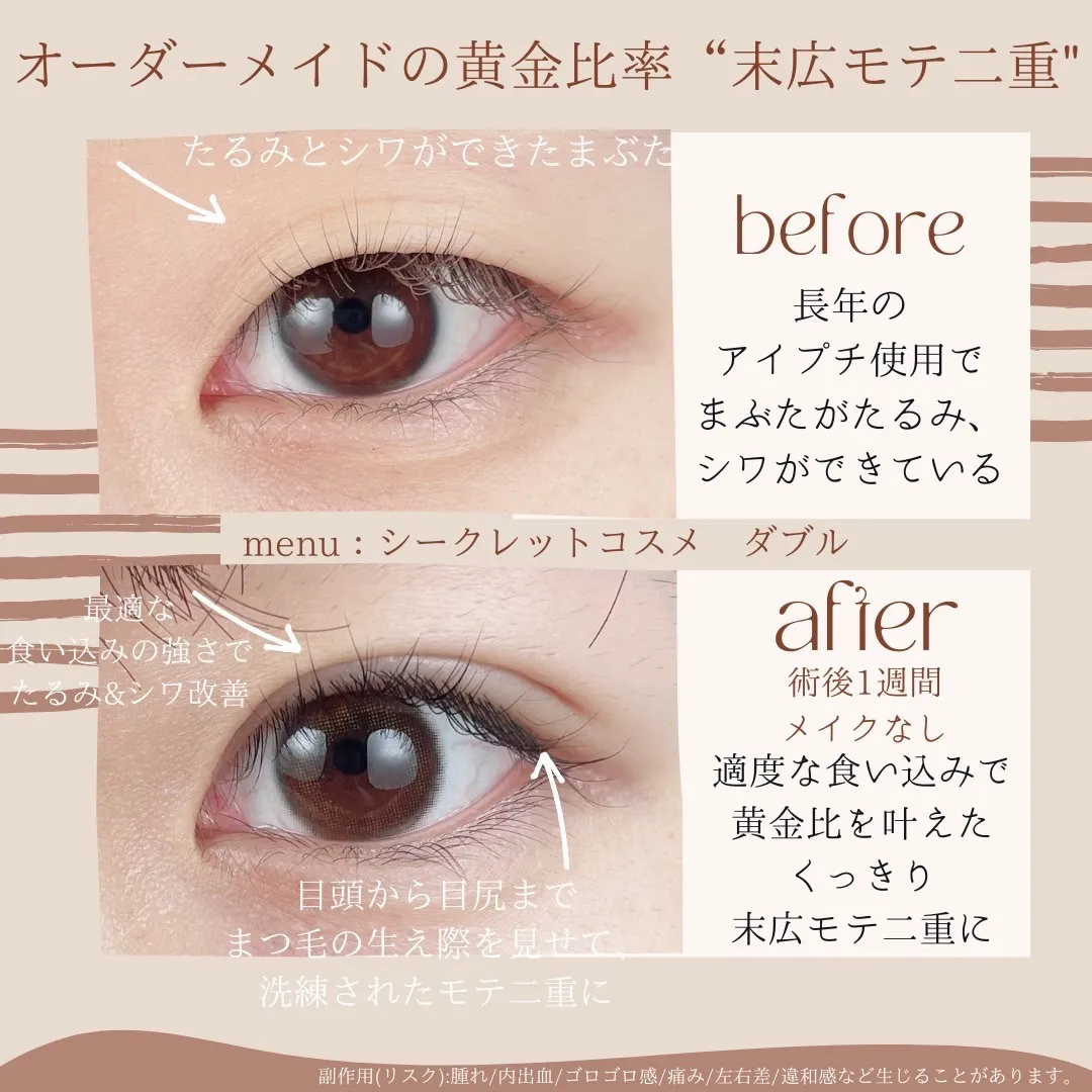 before・after画像