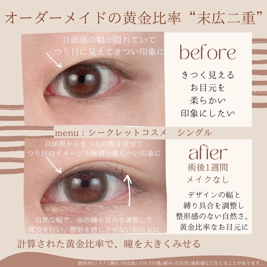 before・after画像