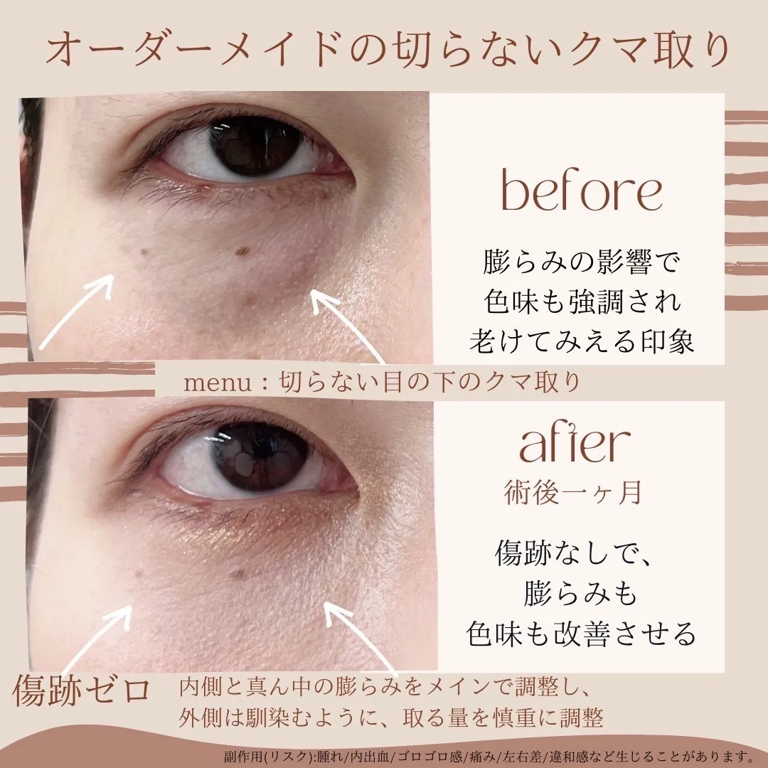 before・after画像