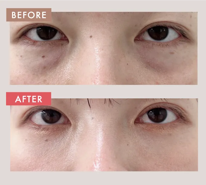 術前と術後の比較写真