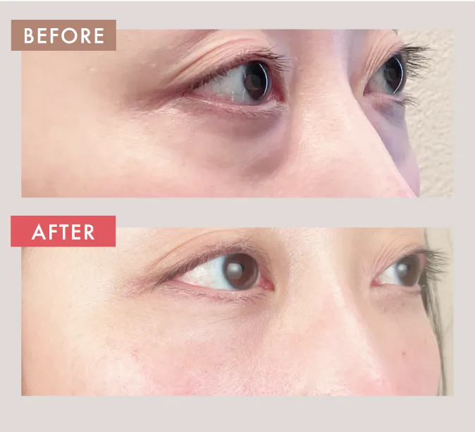 術前と術後の比較写真