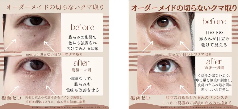 before・after画像