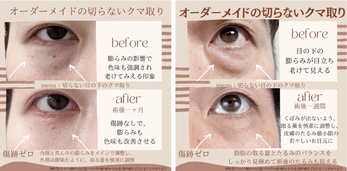 before・after画像