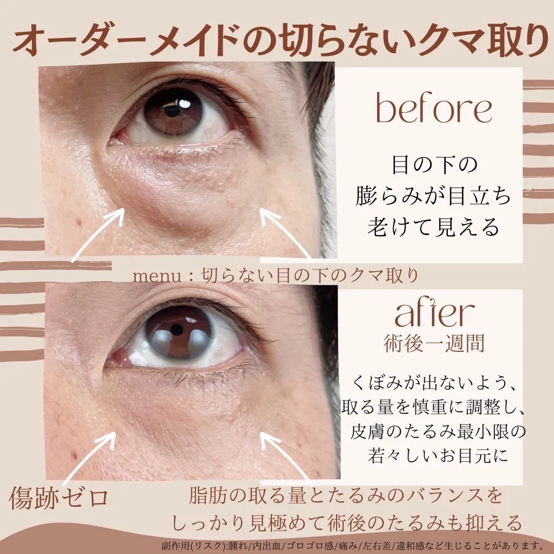 before・after画像