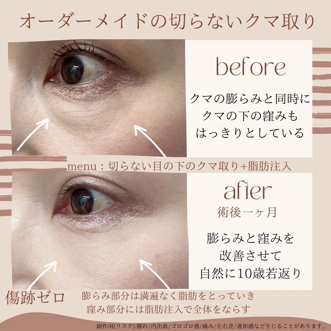 before・after画像